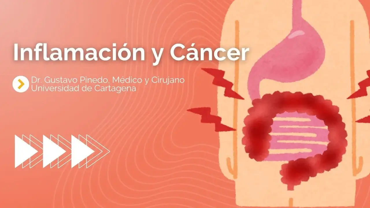 Inflamación y Cáncer con el Dr. Gustavo Pinedo